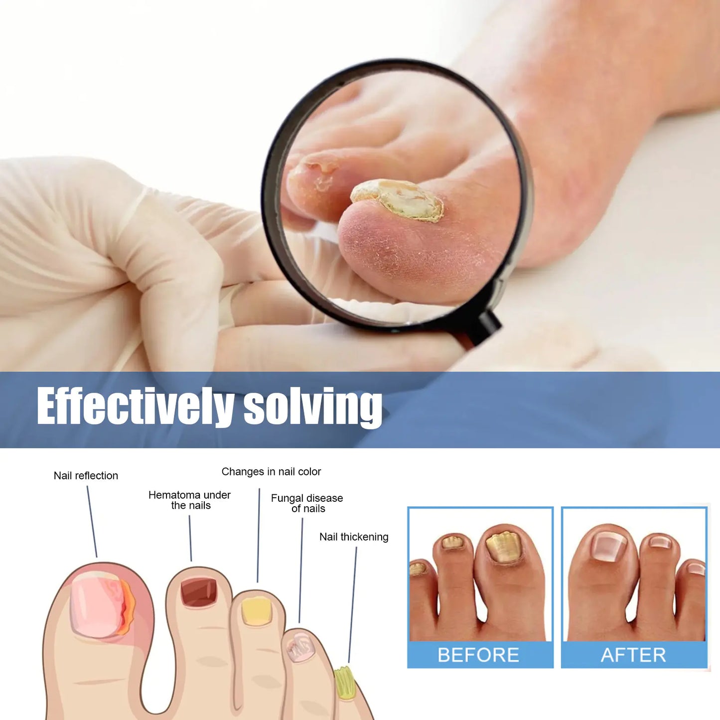Nail Repair Bandage