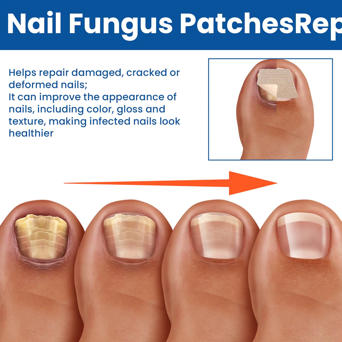 Nail Repair Bandage